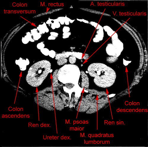 anatomia radiologiczna - 8.gif