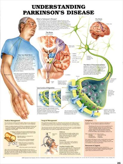 plansze dydaktyczne - budowa ciała człowieka ENG - 56-Choroba Parkinsona.jpg