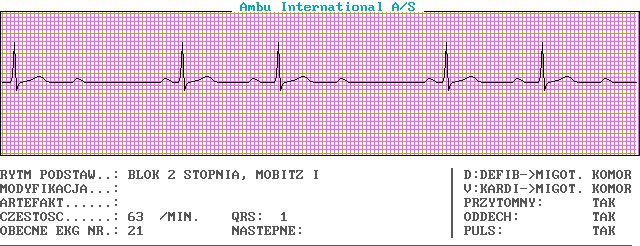 Wykresy EKG - c21-0.png